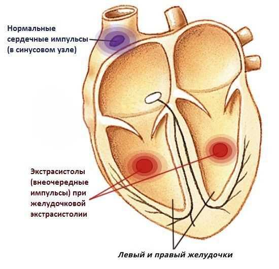 Причины наджелудочковой эктопической активности сердца