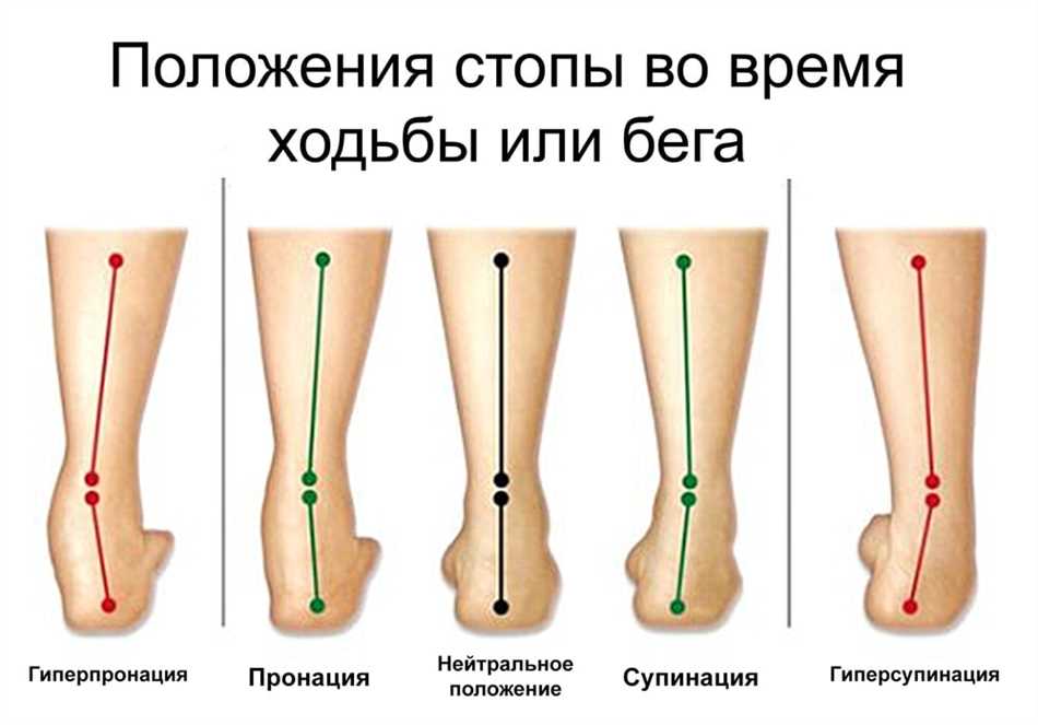 Нейтральная пронация в кроссовках: что это такое