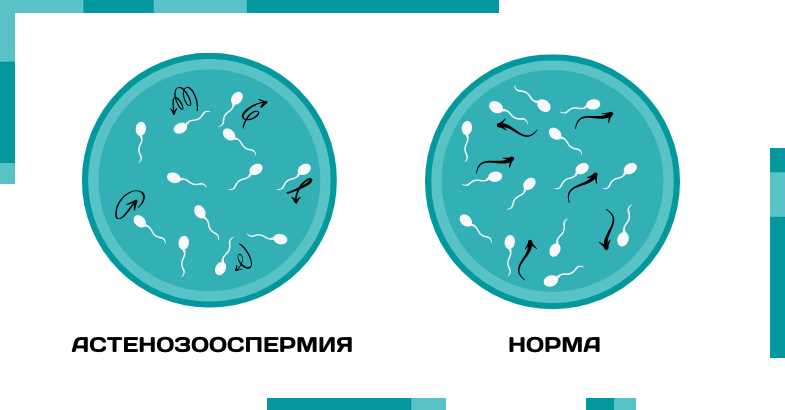 Проблемы, связанные с нормозооспермией