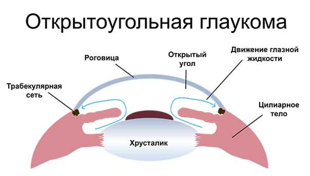 Причины НЖО 1 степени