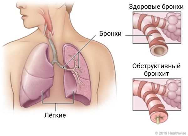 Воздействие внешних факторов