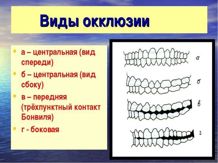 Окклюзия зубов: понятие и особенности