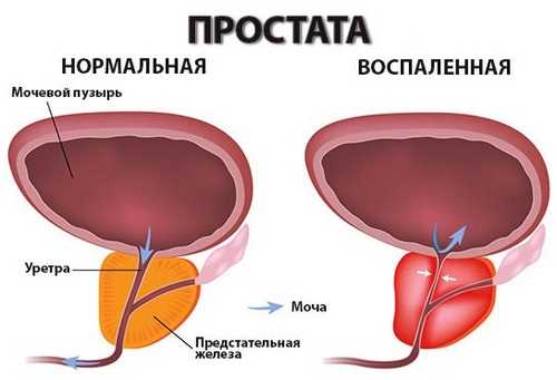 Что можно выявить при осмотре ректального?