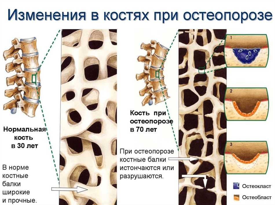 Участие в ремоделировании костей