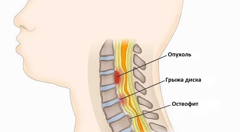 5. Старение