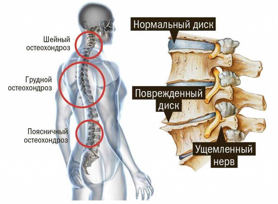 Нарушение чувствительности