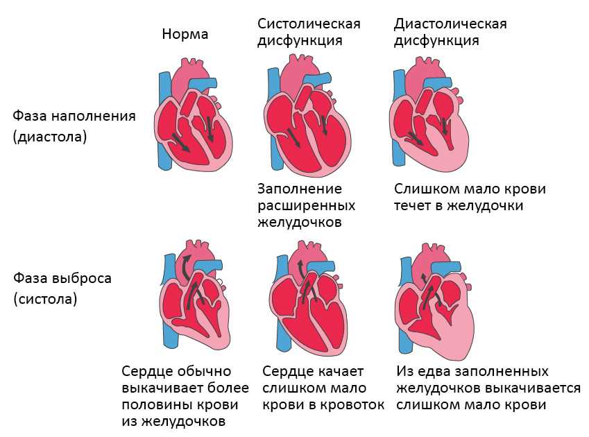 Острое заболевание: причины, симптомы и лечение