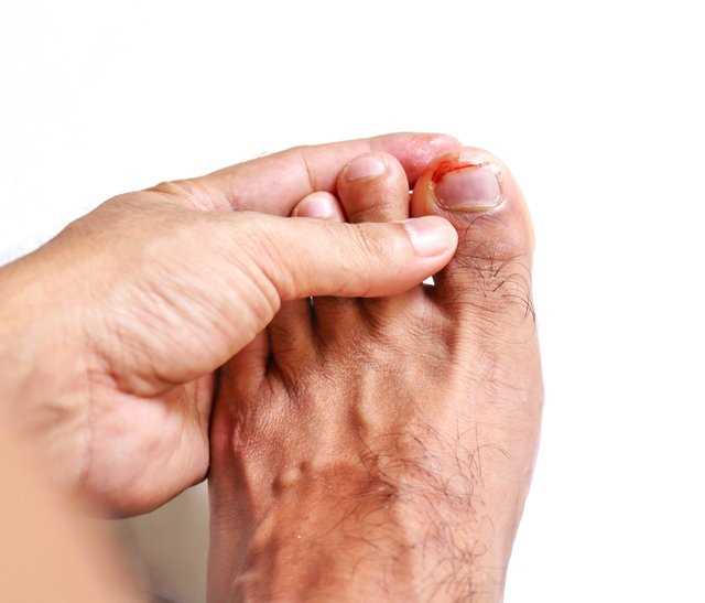 Почему медикам запрещено красить ногти: риски и последствия