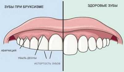 Психологические причины прикусывания языка