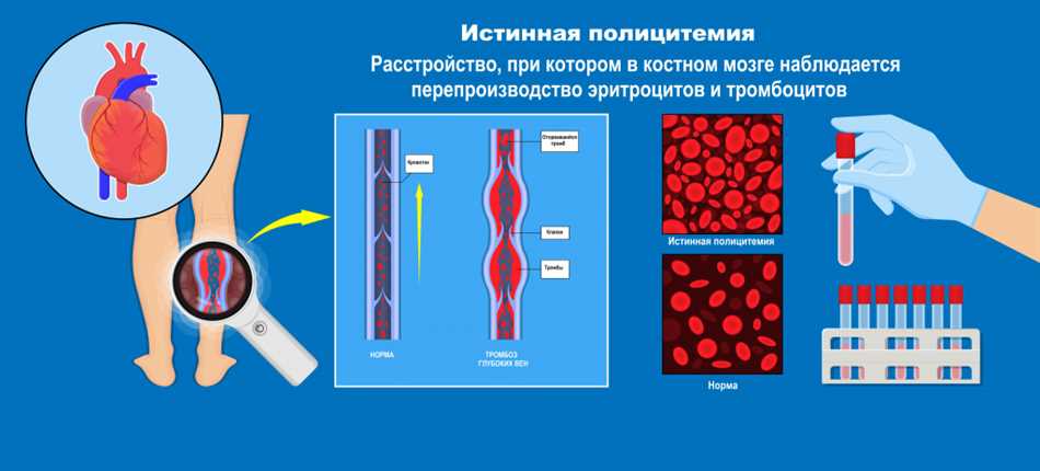 Второй раздел: Причины повышенного значения P-LCR