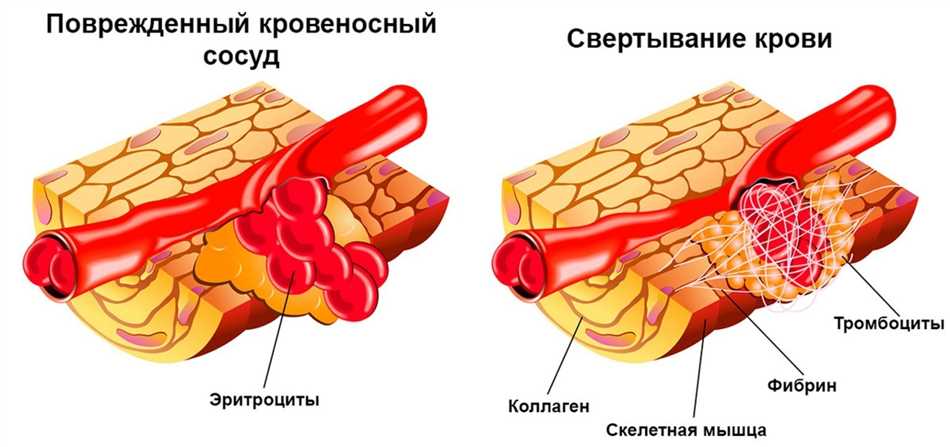 Повышенный коэффициент больших тромбоцитов (P-LCR): причины и значения